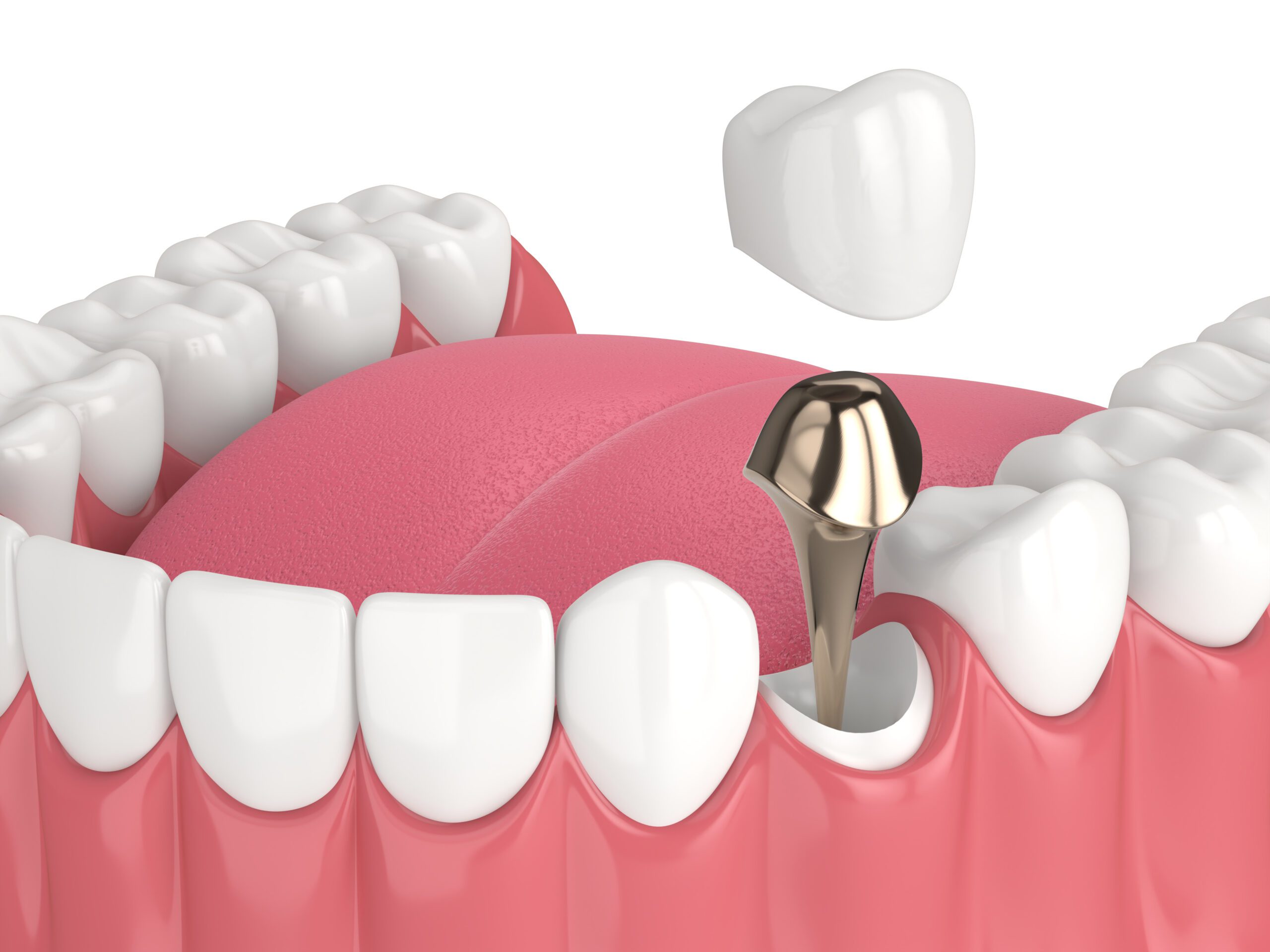 Cinco Dental Care -