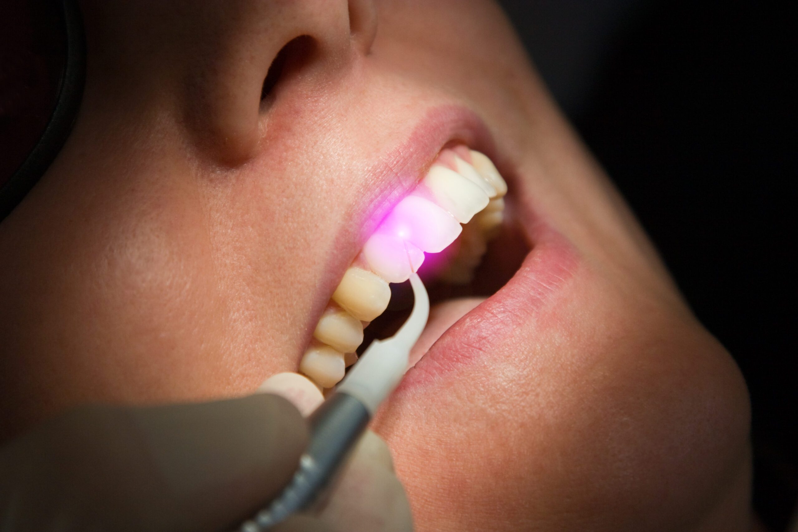 Cinco Dental Care -