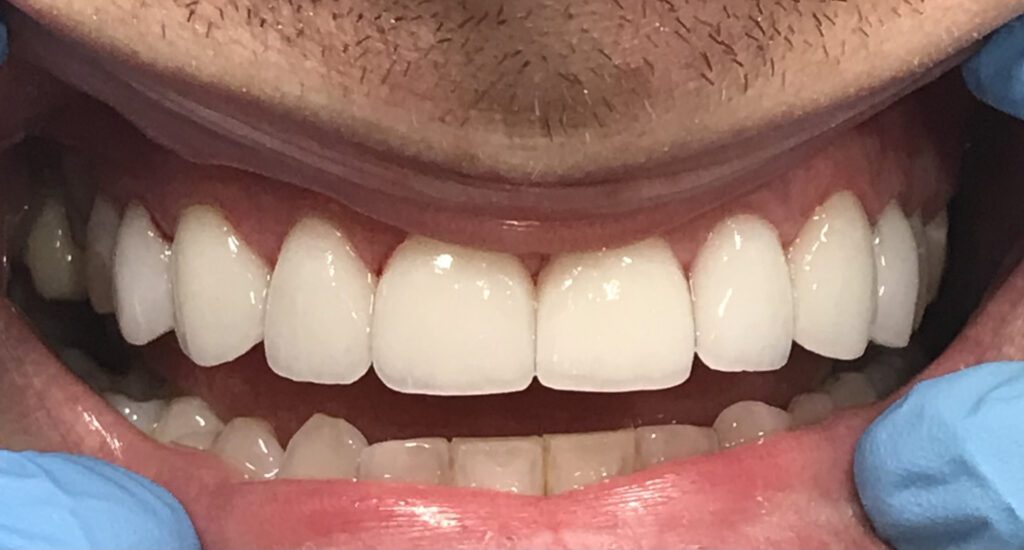 Cinco Dental Care -