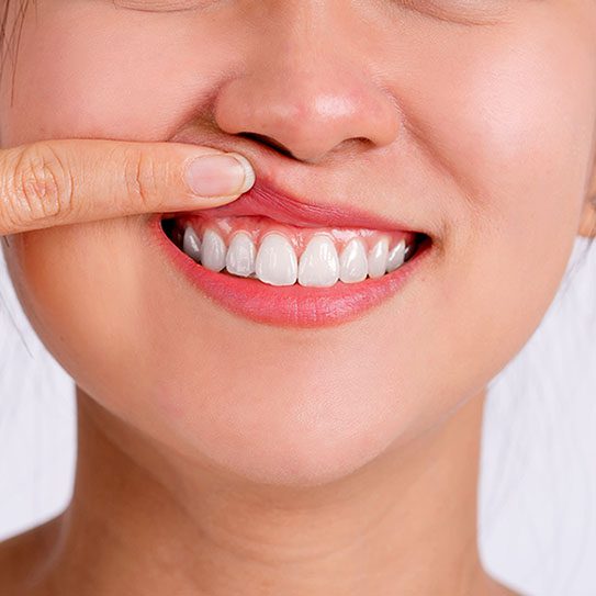 Cinco Dental Care -