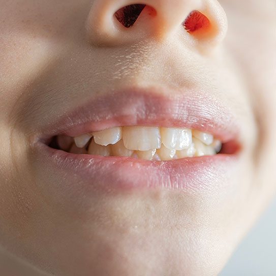 Cinco Dental Care -